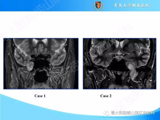 【PPT】颅底孔道的影像解剖和诊断