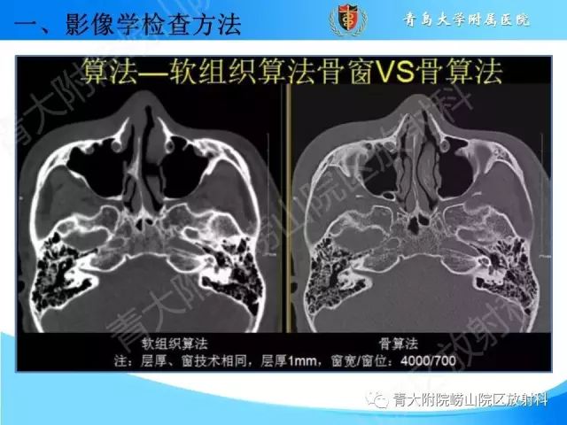 【PPT】颅底孔道的影像解剖和诊断