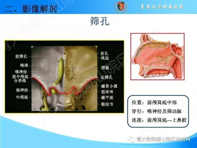 【PPT】颅底孔道的影像解剖和诊断