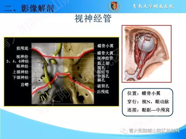 【PPT】颅底孔道的影像解剖和诊断