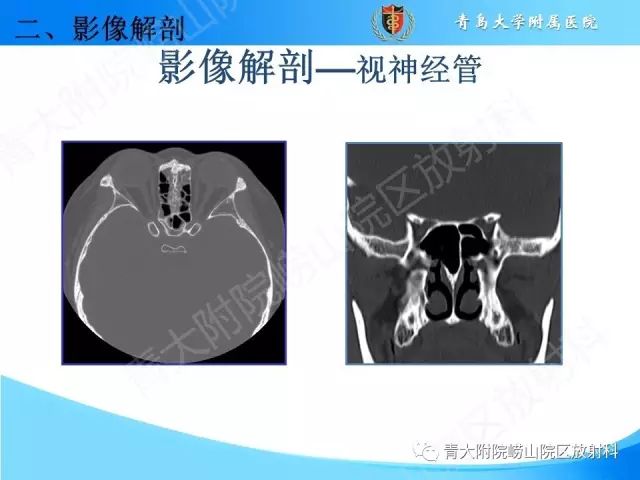 【PPT】颅底孔道的影像解剖和诊断
