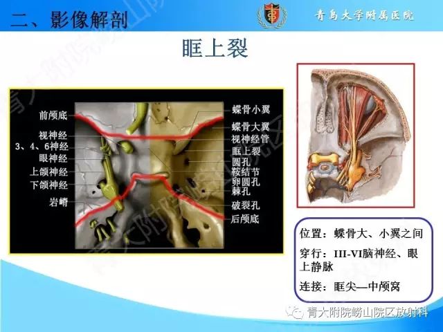 【PPT】颅底孔道的影像解剖和诊断