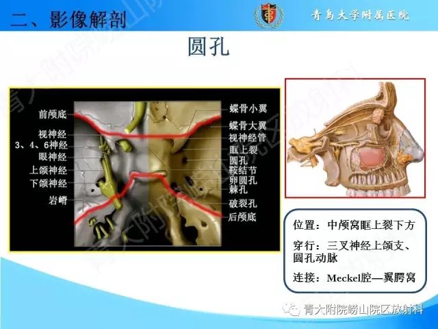 【PPT】颅底孔道的影像解剖和诊断