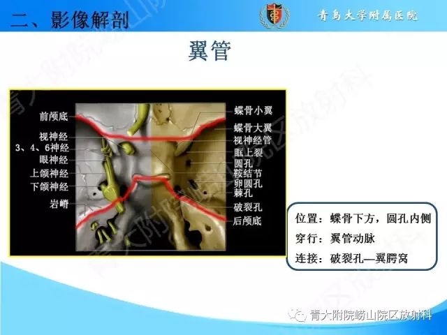 【PPT】颅底孔道的影像解剖和诊断