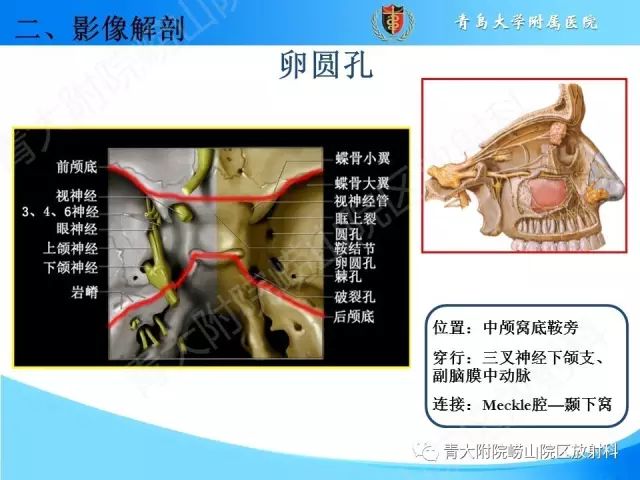 【PPT】颅底孔道的影像解剖和诊断