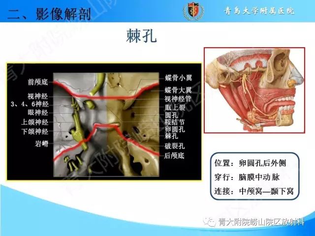 【PPT】颅底孔道的影像解剖和诊断