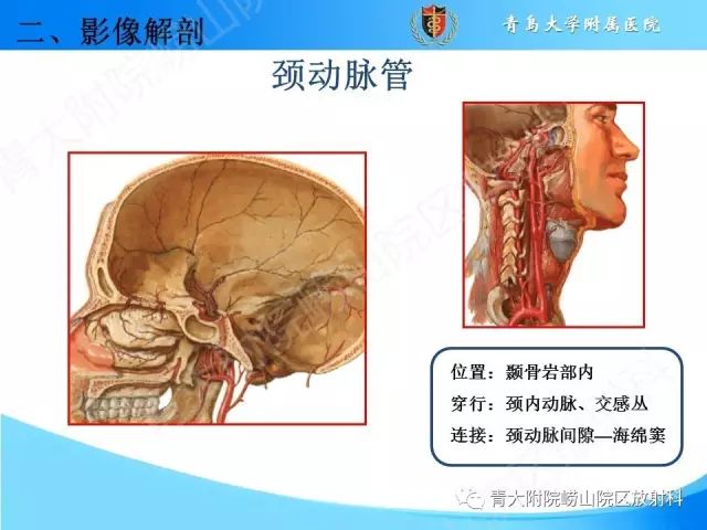 【PPT】颅底孔道的影像解剖和诊断