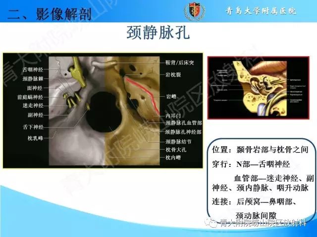 【PPT】颅底孔道的影像解剖和诊断