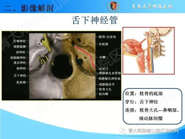 【PPT】颅底孔道的影像解剖和诊断