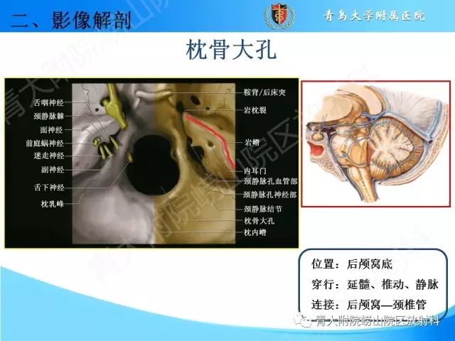【PPT】颅底孔道的影像解剖和诊断
