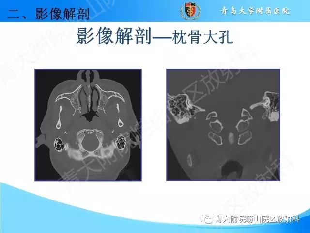 【PPT】颅底孔道的影像解剖和诊断