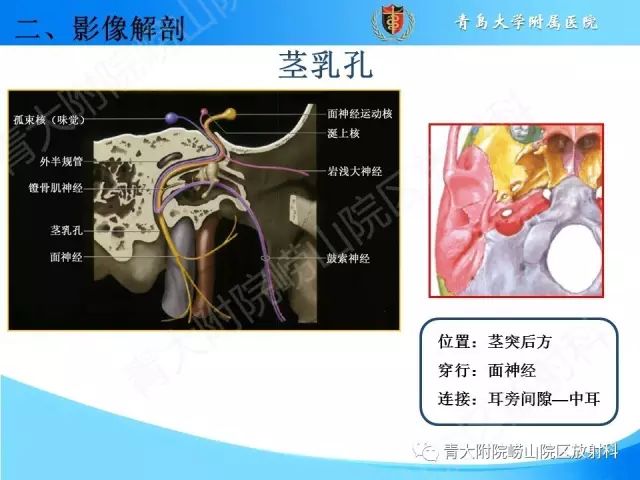 【PPT】颅底孔道的影像解剖和诊断