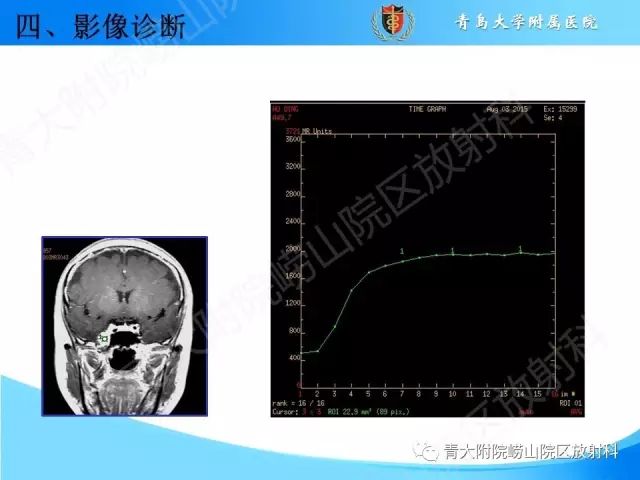【PPT】颅底孔道的影像解剖和诊断