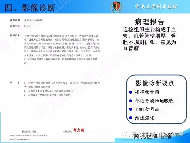 【PPT】颅底孔道的影像解剖和诊断