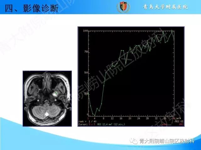 【PPT】颅底孔道的影像解剖和诊断