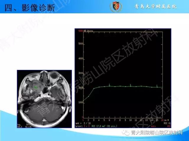 【PPT】颅底孔道的影像解剖和诊断