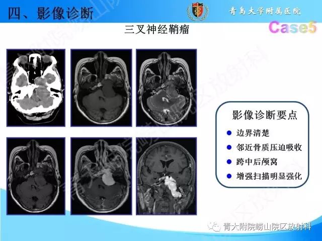 【PPT】颅底孔道的影像解剖和诊断