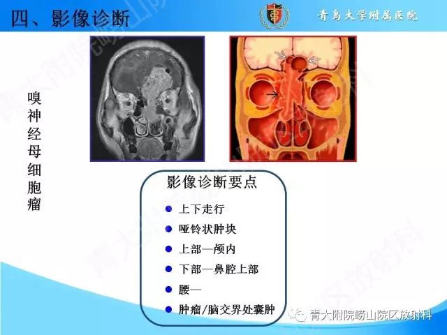 【PPT】颅底孔道的影像解剖和诊断