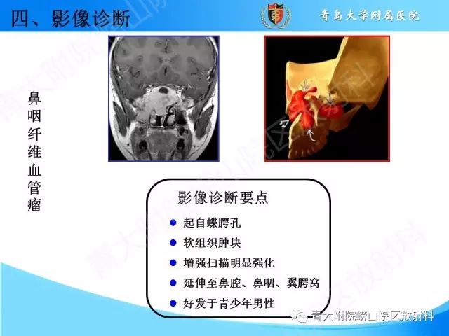 【PPT】颅底孔道的影像解剖和诊断