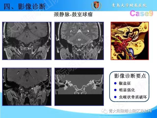 【PPT】颅底孔道的影像解剖和诊断