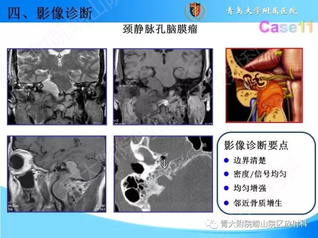 【PPT】颅底孔道的影像解剖和诊断