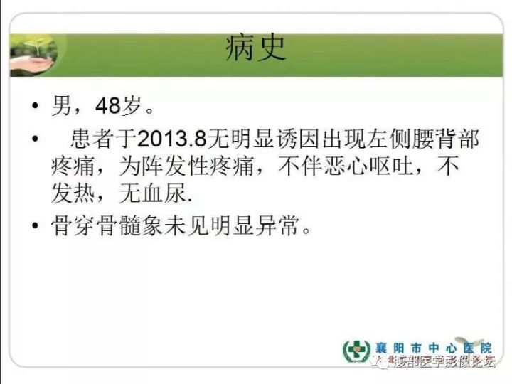 【病例】左肾孤立性浆细胞瘤1例CT