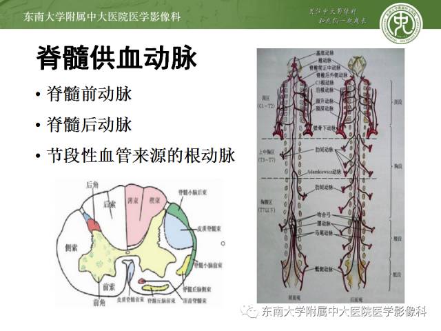 【病例】脊髓前动脉综合征1例MR