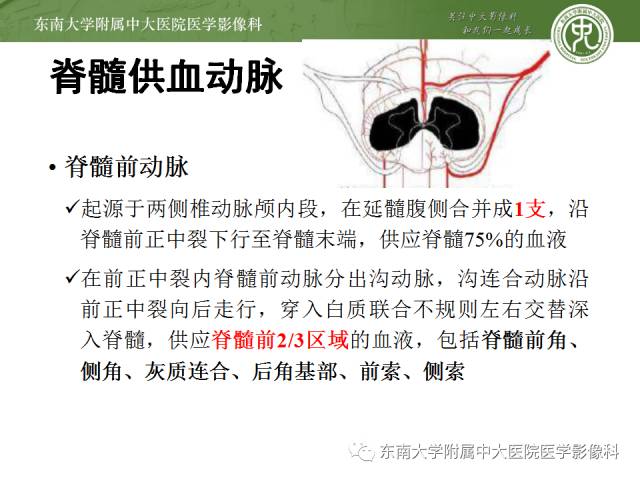 【病例】脊髓前动脉综合征1例MR