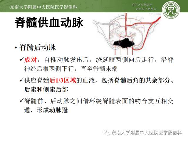 【病例】脊髓前动脉综合征1例MR