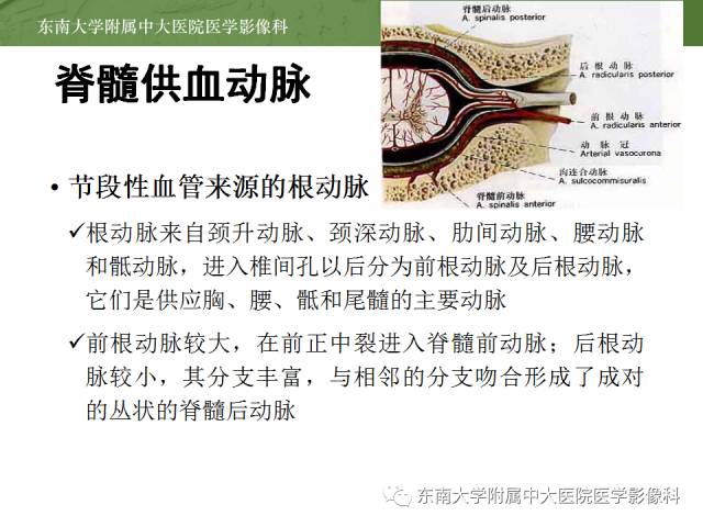 【病例】脊髓前动脉综合征1例MR
