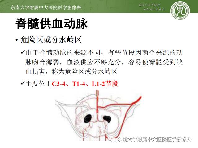 【病例】脊髓前动脉综合征1例MR