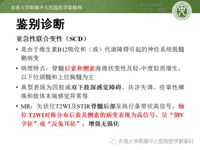 【病例】脊髓前动脉综合征1例MR