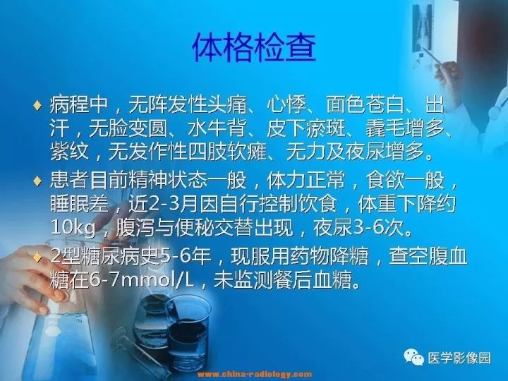 【病例】肾上腺神经节细胞瘤1例CT及MR 【病例】肾上腺神经节细胞瘤1例CT及MR