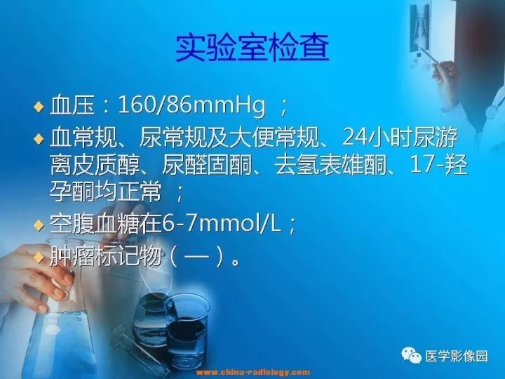 【病例】肾上腺神经节细胞瘤1例CT及MR 【病例】肾上腺神经节细胞瘤1例CT及MR