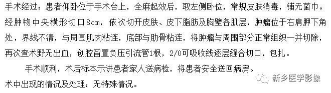 会让您过目不忘的背部弹力纤维瘤,你了解吗? 会让您过目不忘的背部弹力纤维瘤,你了解吗?