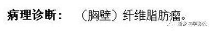 会让您过目不忘的背部弹力纤维瘤,你了解吗? 会让您过目不忘的背部弹力纤维瘤,你了解吗?