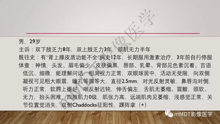 【病例】肾上腺脊髓神经病1例MR