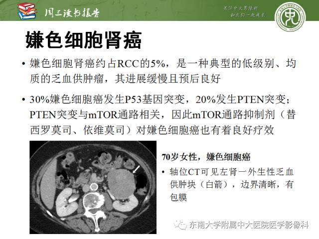 【PPT】晚期肾细胞癌：影像医生在精准医学时代中的作用