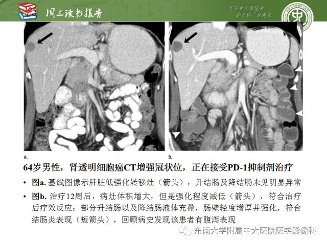 【PPT】晚期肾细胞癌：影像医生在精准医学时代中的作用