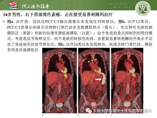 【PPT】晚期肾细胞癌：影像医生在精准医学时代中的作用