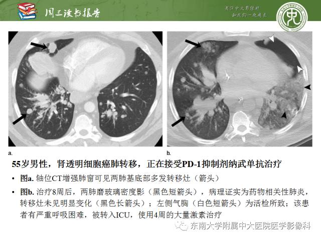 【PPT】晚期肾细胞癌：影像医生在精准医学时代中的作用