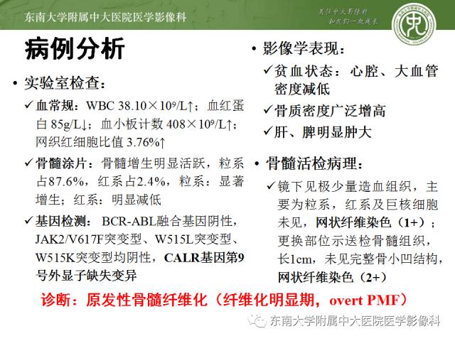 【病例】骨髓纤维化1例CT 【病例】骨髓纤维化1例CT