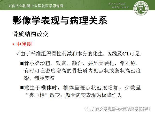 【病例】骨髓纤维化1例CT 【病例】骨髓纤维化1例CT