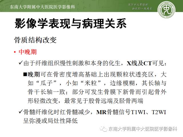 【病例】骨髓纤维化1例CT 【病例】骨髓纤维化1例CT
