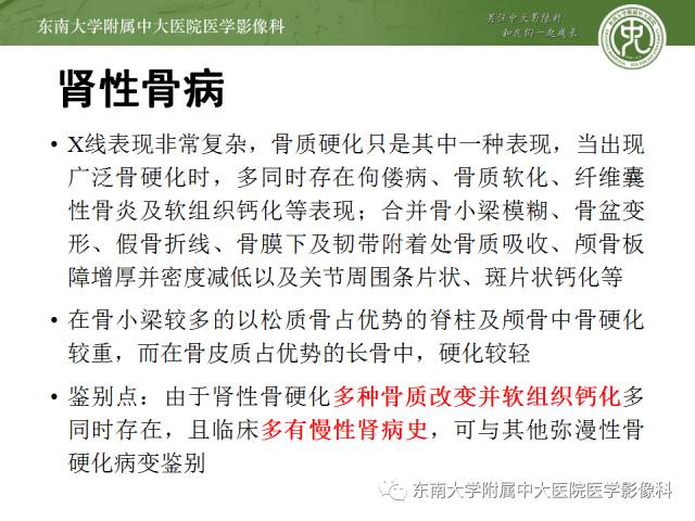 【病例】骨髓纤维化1例CT 【病例】骨髓纤维化1例CT