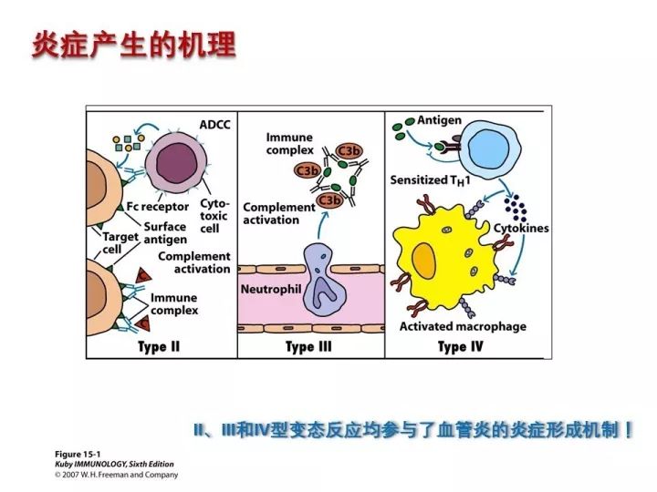 【PPT】中枢神经系统血管炎的临床思考