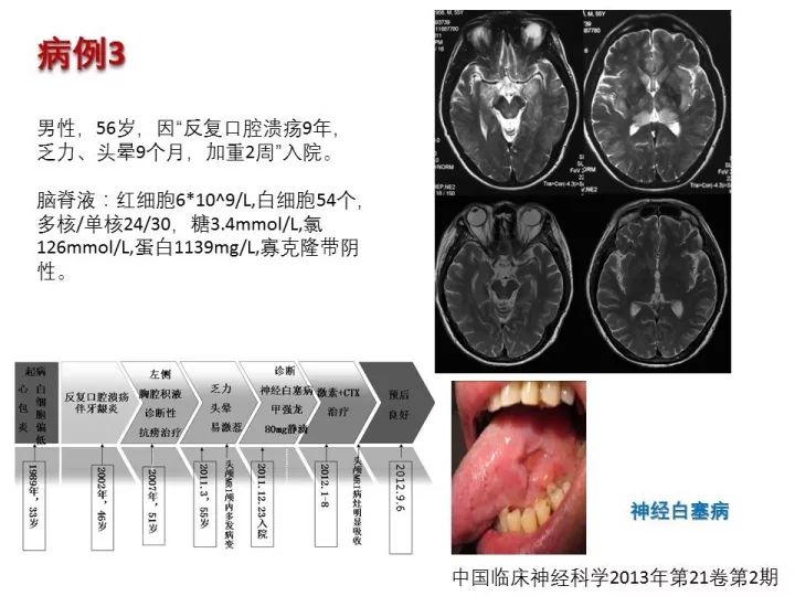 【PPT】中枢神经系统血管炎的临床思考