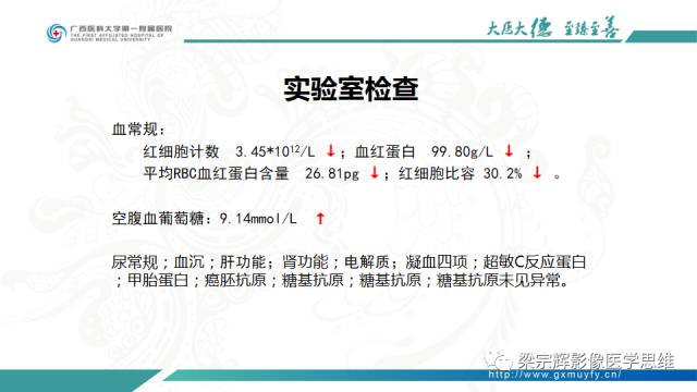 【病例】肠壁异位胰腺1例CT影像表现