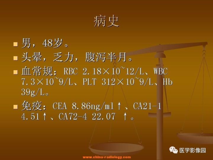 【病例】结肠粘液腺癌1例CT影像表现