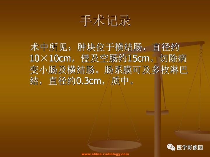【病例】结肠粘液腺癌1例CT影像表现